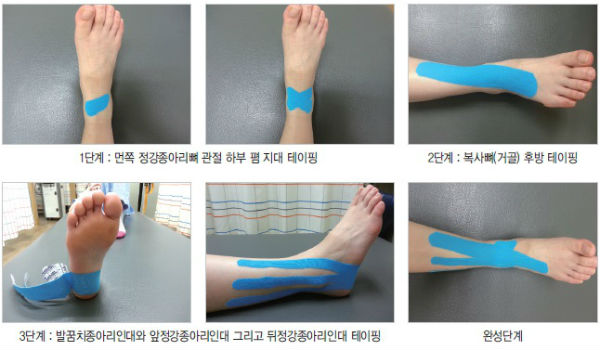 발목 테이핑 단계별 가이드