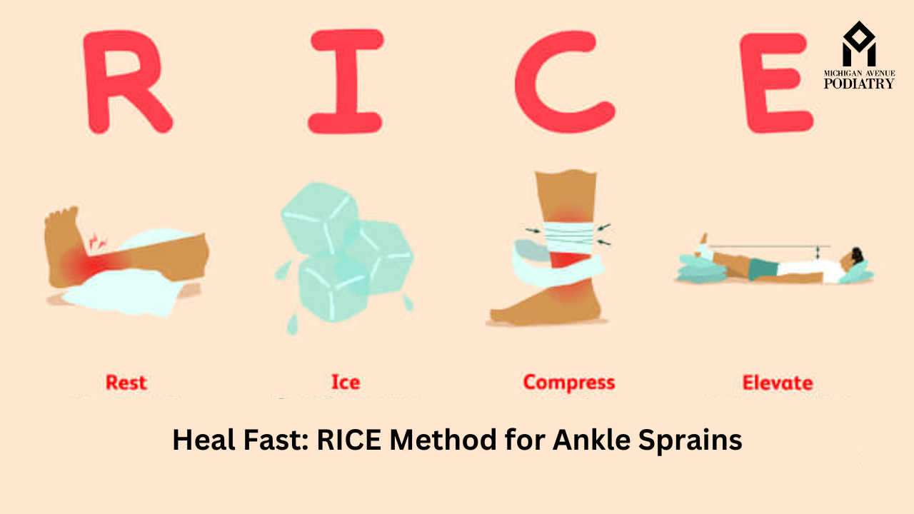 RICE 응급조치 인포그래픽