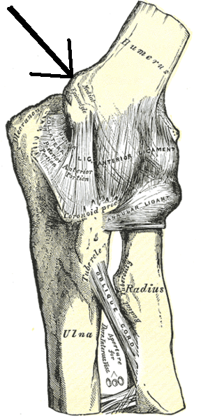 내측상과(Medial Epicondyle) 해부도 — 골프엘보 발생 위치